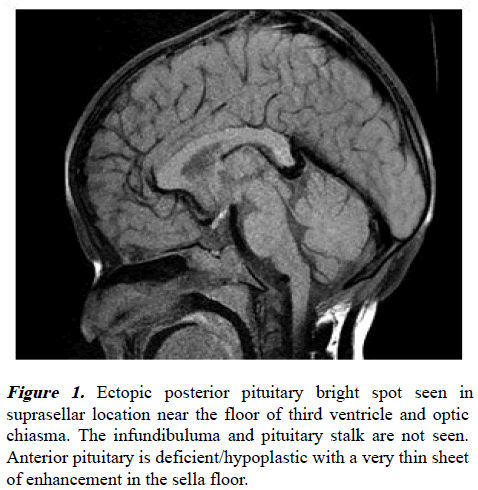 aajcp-Ectopic