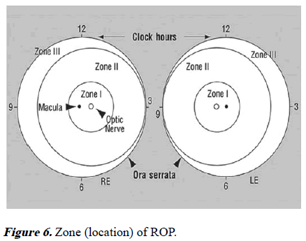 aajcp-Zone