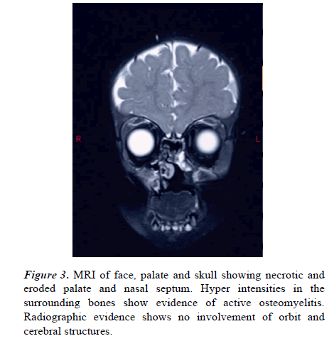 current-pediatric-plate