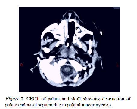 current-pediatric-skull