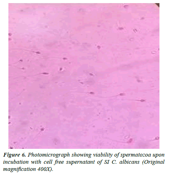 Alterations in human sperm parameters as a corollary of incubation with ...